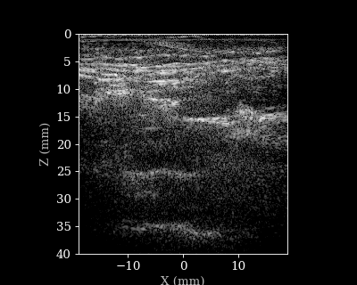 B-mode sequence