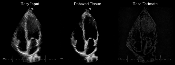 Dehazing Results